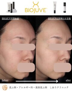 BIOJUVÉ バイオジューブ フルセット(おまけ付き) BIOJUVÉ バイオ