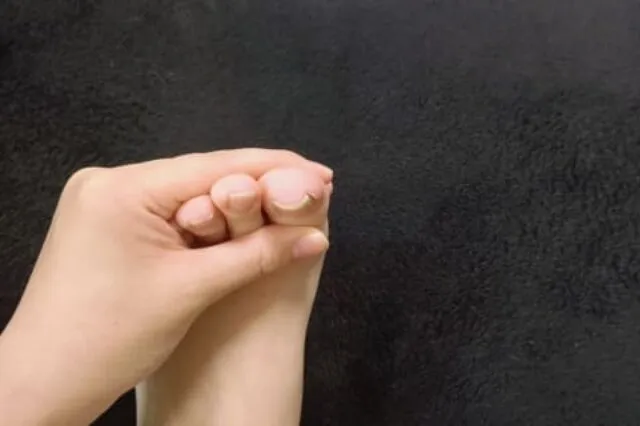 当院の巻き爪治療