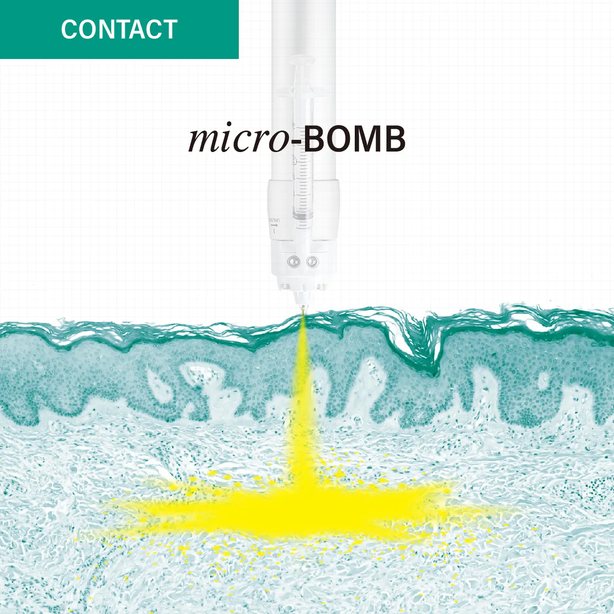 コンタクトモード